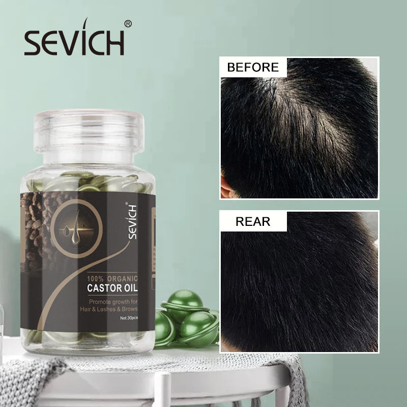 SEVICH Ginger Hair Growth Capsule Set