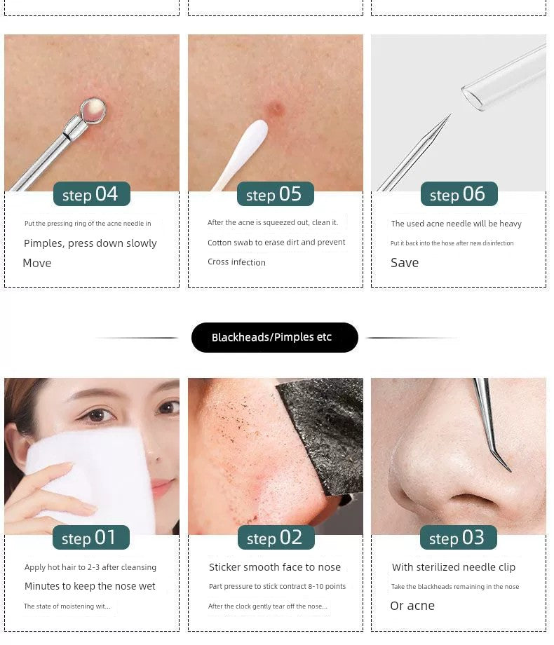 Blackhead Removal Tweezers