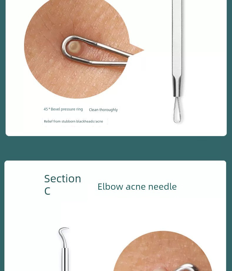 Blackhead Removal Tweezers