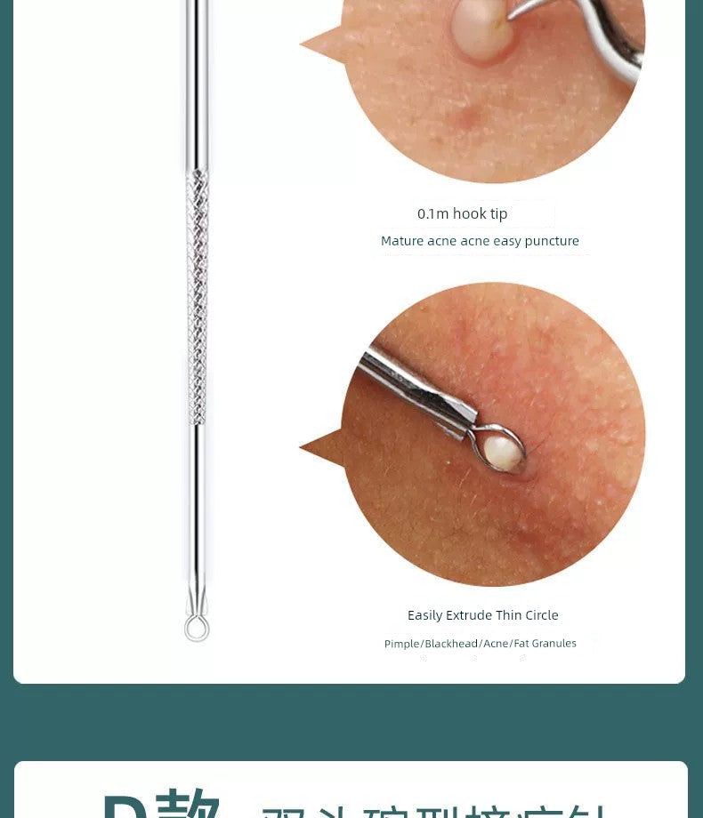 Blackhead Removal Tweezers