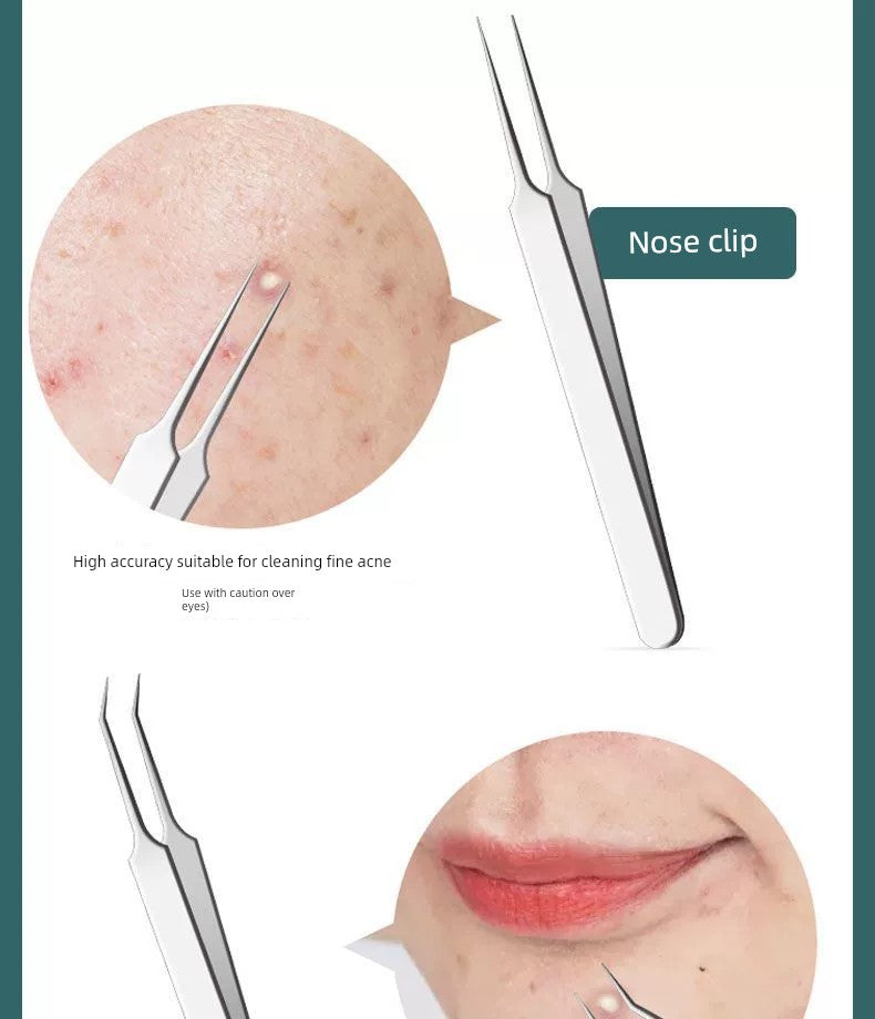 Blackhead Removal Tweezers