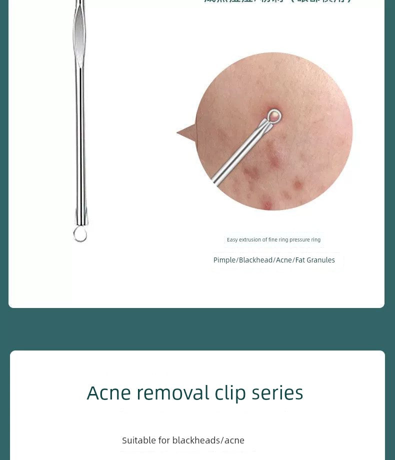 Blackhead Removal Tweezers