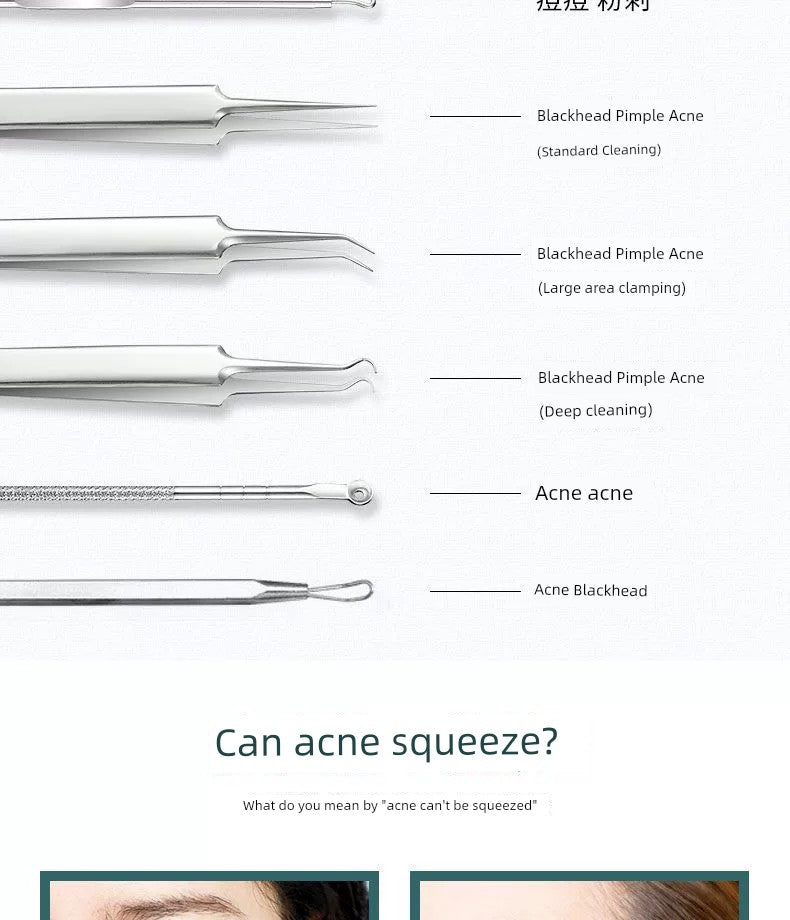 Blackhead Removal Tweezers