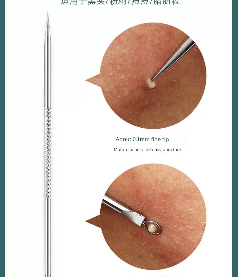 Blackhead Removal Tweezers